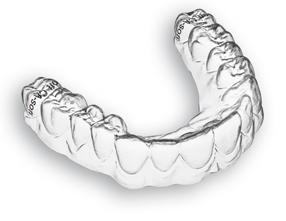 Aligner-Schienen
